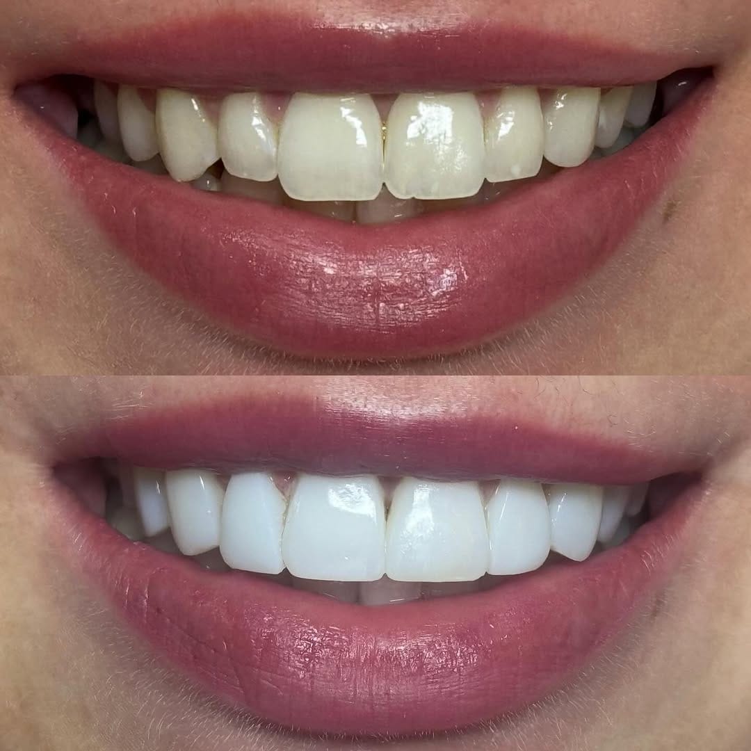 Post 4 by Dr Rebecca Tonner on Instagram (image)