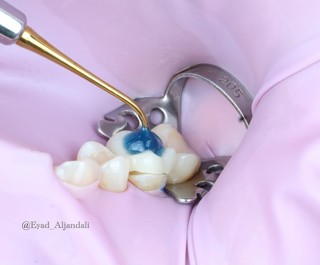 Post 1 by Dr Eyad Aljandali on Instagram (carousel)
