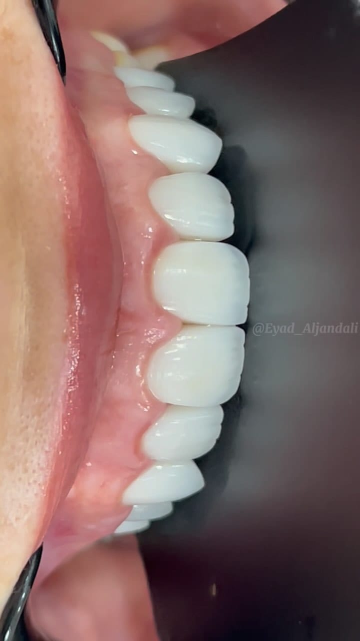 Post 6 by Dr Eyad Aljandali on Instagram (video)