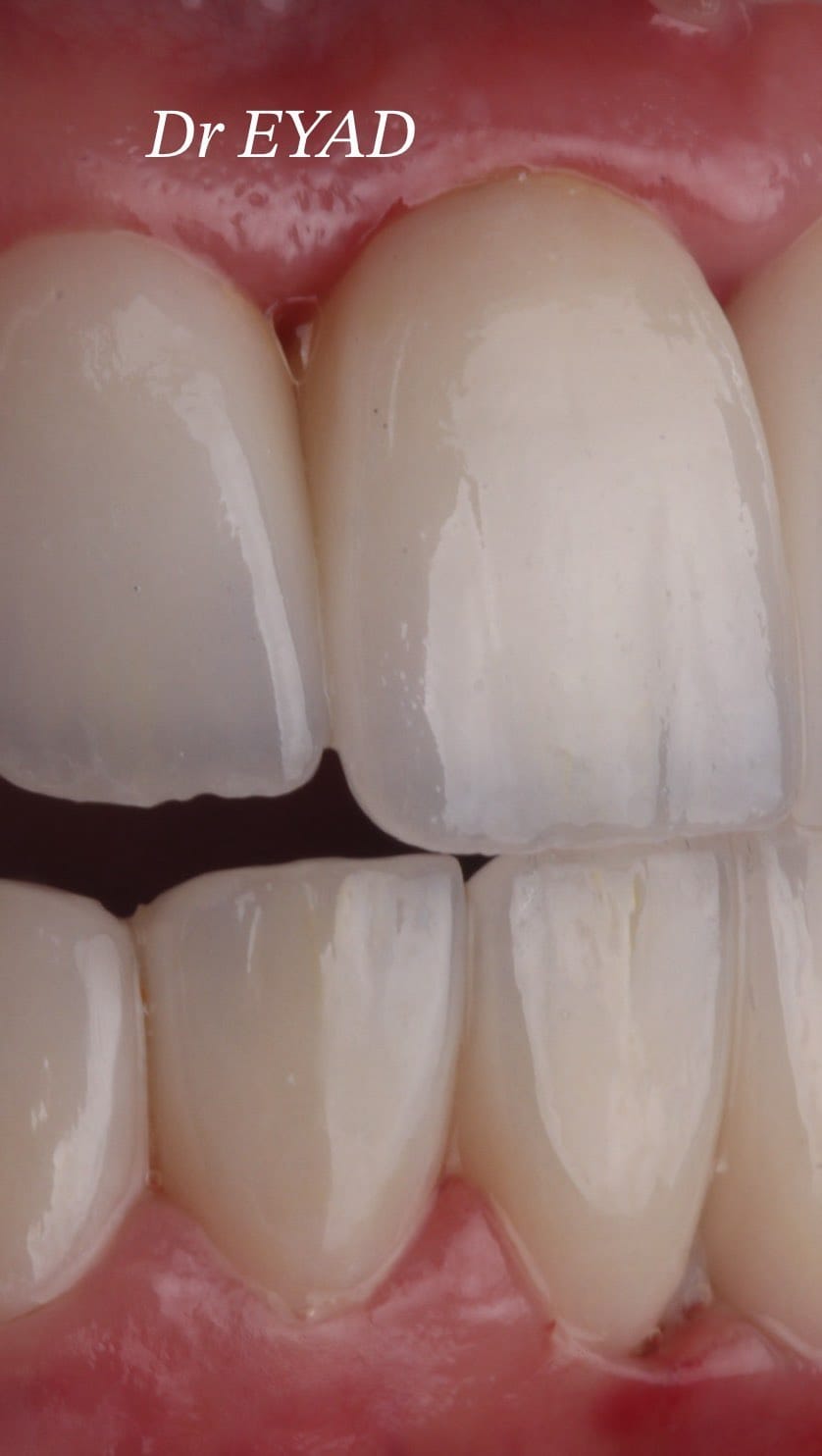 Post 7 by Dr Eyad Aljandali on Instagram (video)