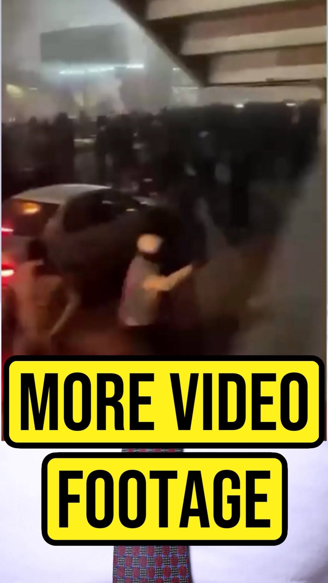 Post 4 by Dr. Keyan Zomorodi, MBBS, Bsc on Instagram (video)
