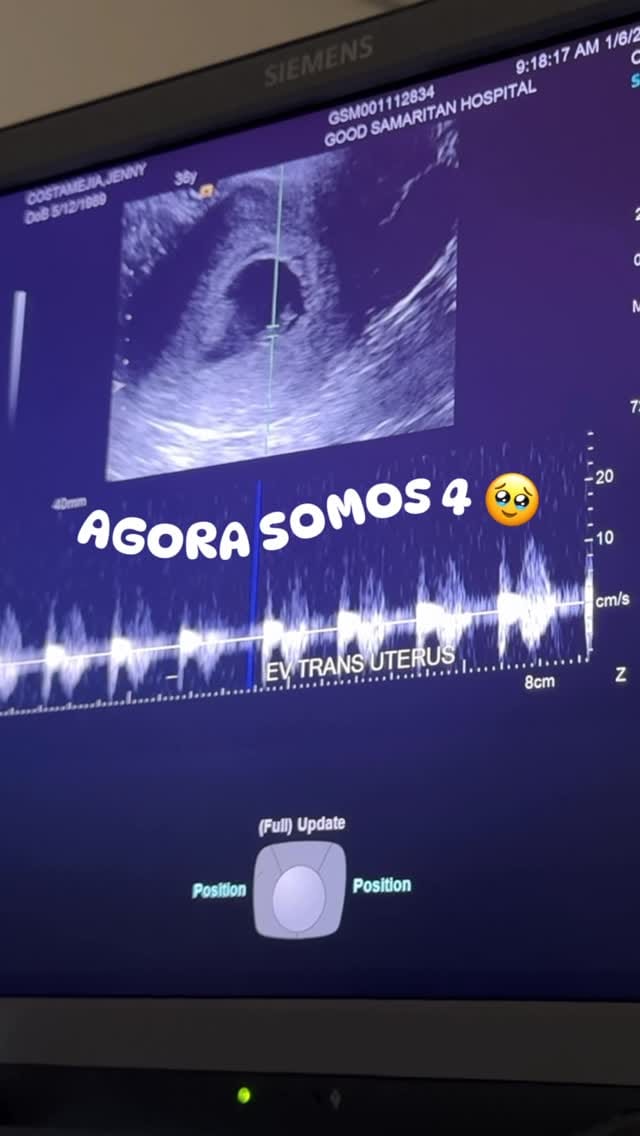 Post 9 by Jenny Mejia on Instagram (video)