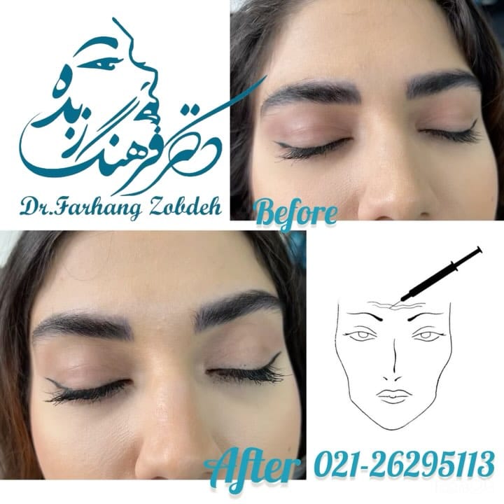 Post 5 by Dr Farhang Zobdeh  دکتر فرهنگ زبده on Instagram (carousel)