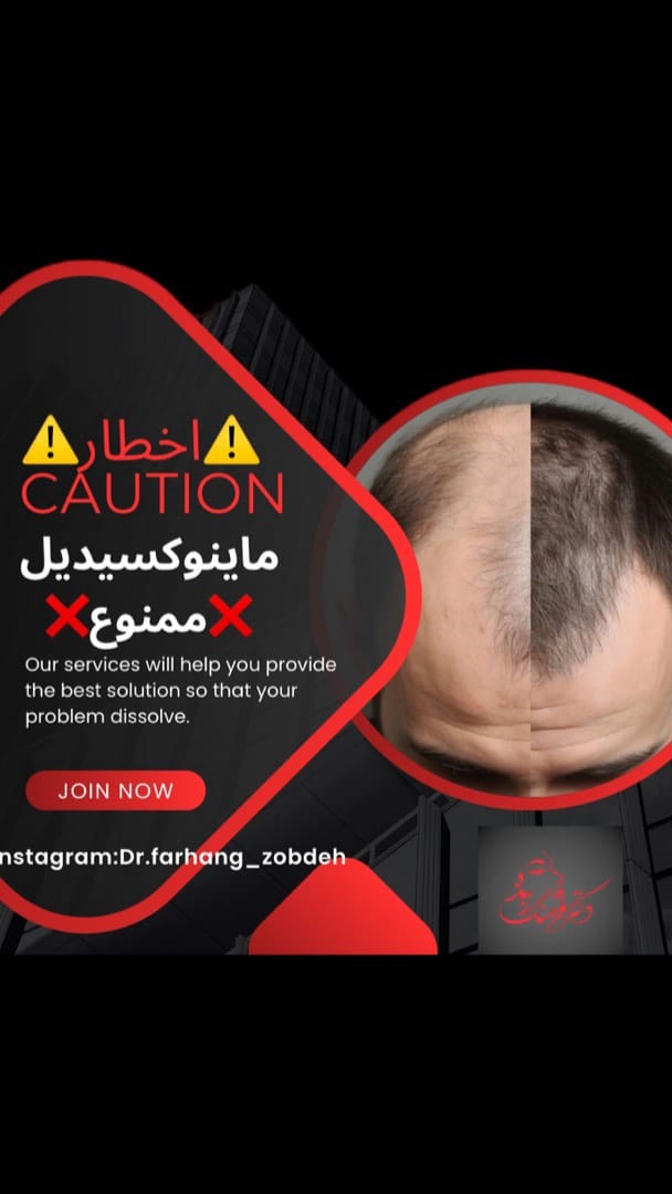 Post 4 by Dr Farhang Zobdeh  دکتر فرهنگ زبده on Instagram (video)