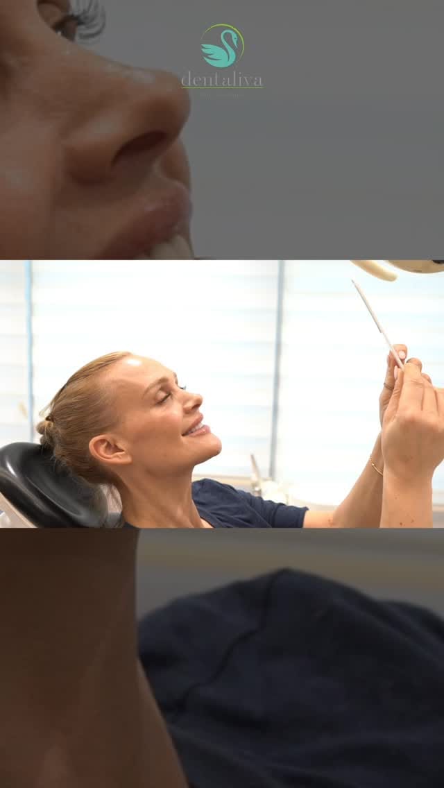 Post 7 by Dentaliva International on Instagram (video)