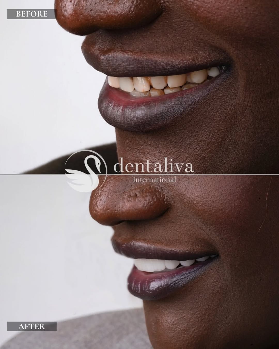 Post 9 by Dentaliva International on Instagram (image)