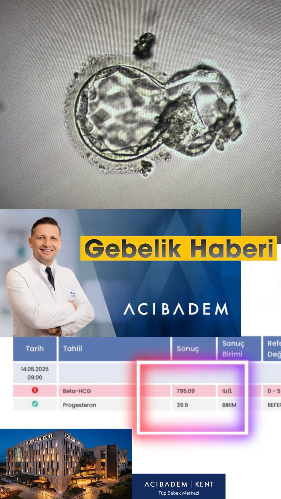 Post 2 by Op. 𝙳𝚛 Ö𝚖ü𝚛 𝙰𝚕𝚋𝚊𝚢𝚛𝚊𝙺 on Instagram (video)