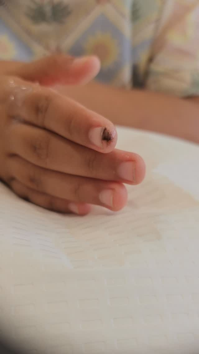 Post 7 by A/Professor Deshan Sebaratnam on Instagram (video)