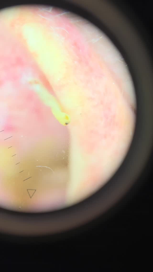 Post 9 by A/Professor Deshan Sebaratnam on Instagram (video)