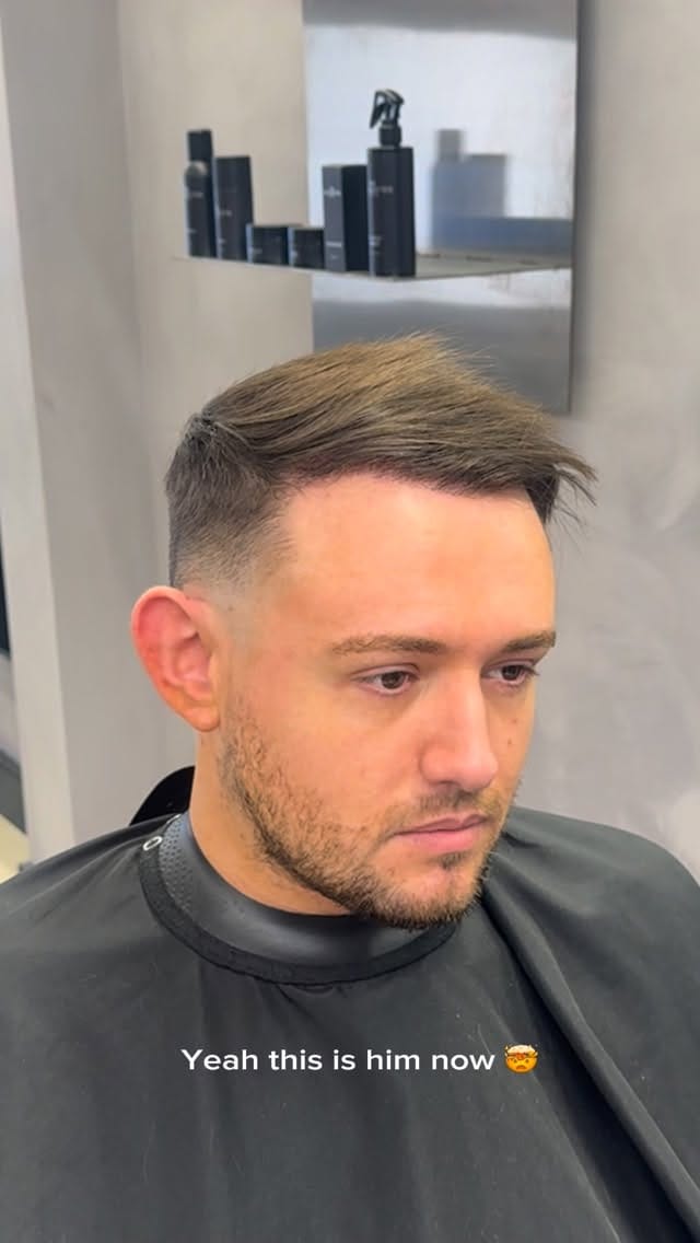 Post 3 by KSL Clinic | Hair Transplant on Instagram (video)