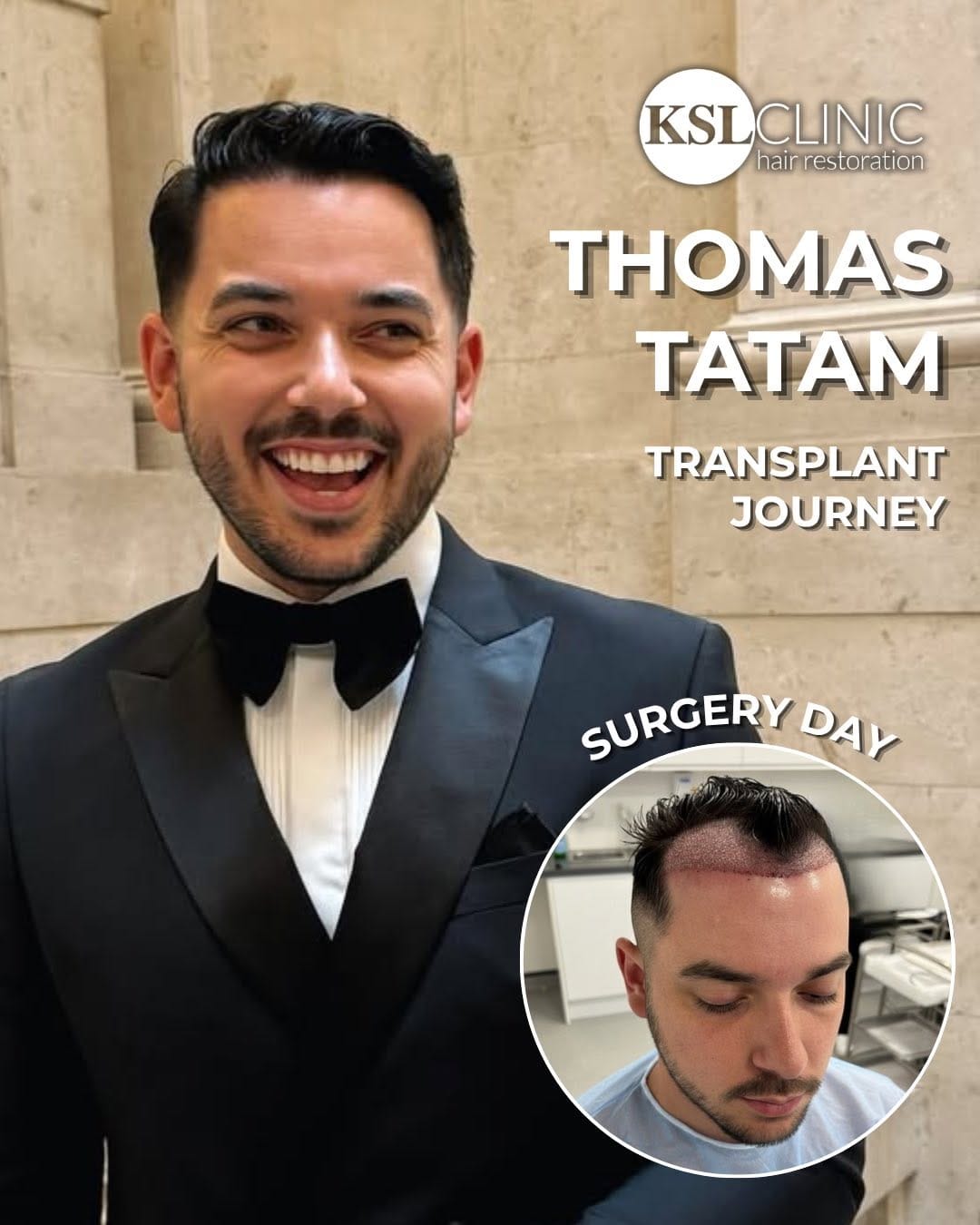Post 8 by KSL Clinic | Hair Transplant on Instagram (carousel)