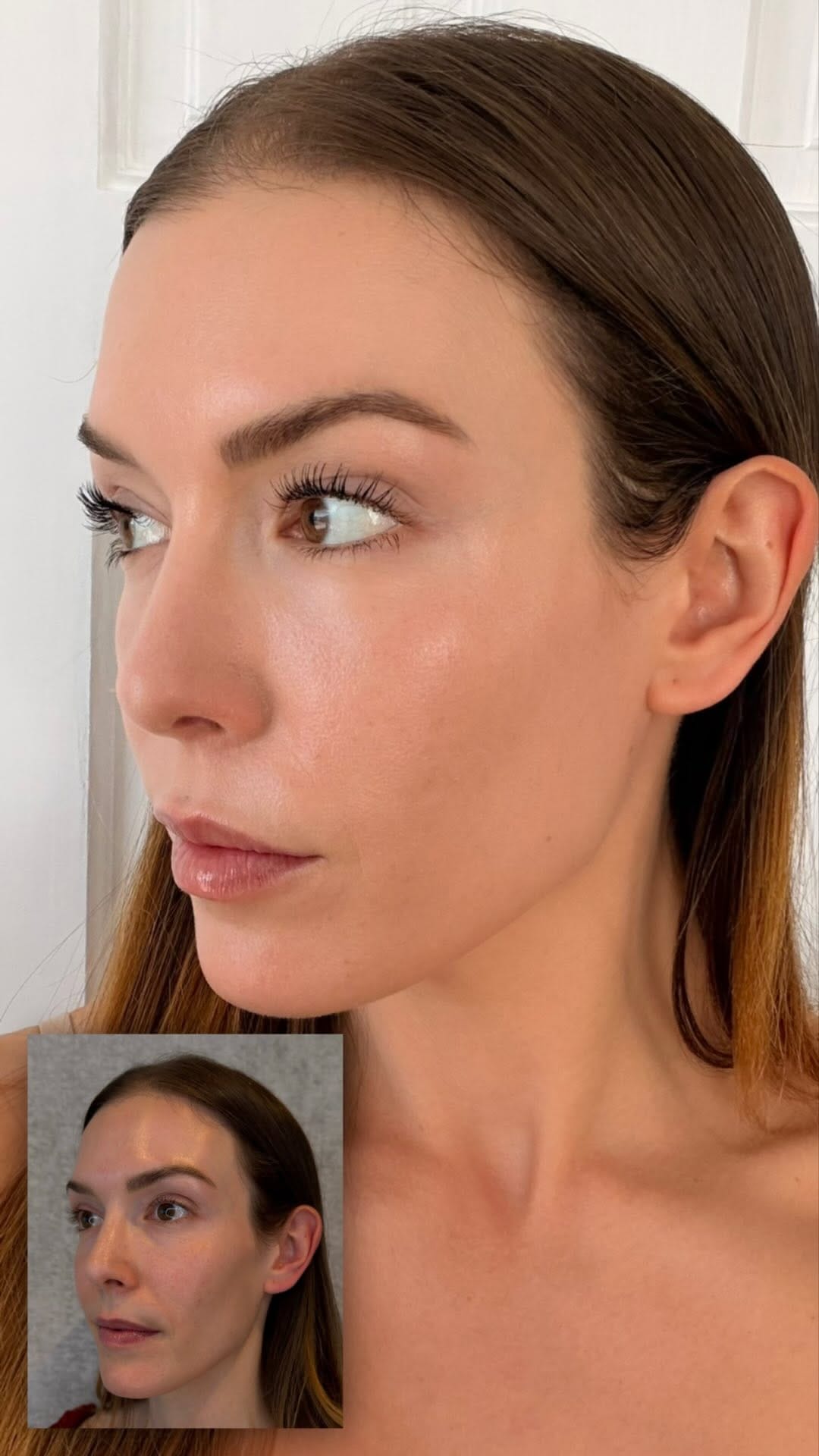 Post 5 by The Aesthetic Centers on Instagram (video)