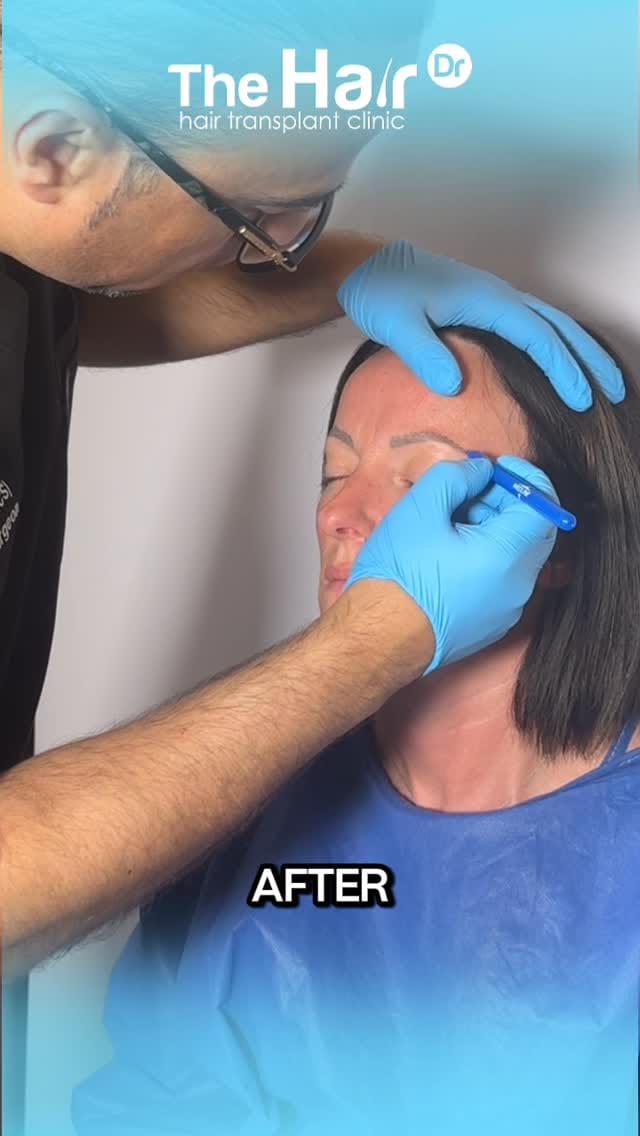 Post 1 by The Hair Dr clinic on Instagram (video)