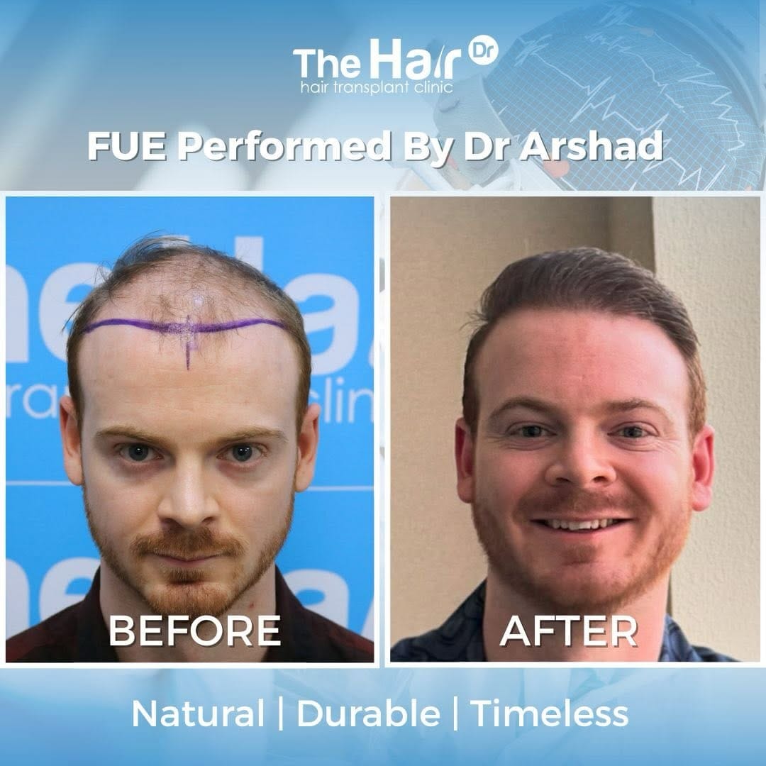 Post 6 by The Hair Dr clinic on Instagram (image)