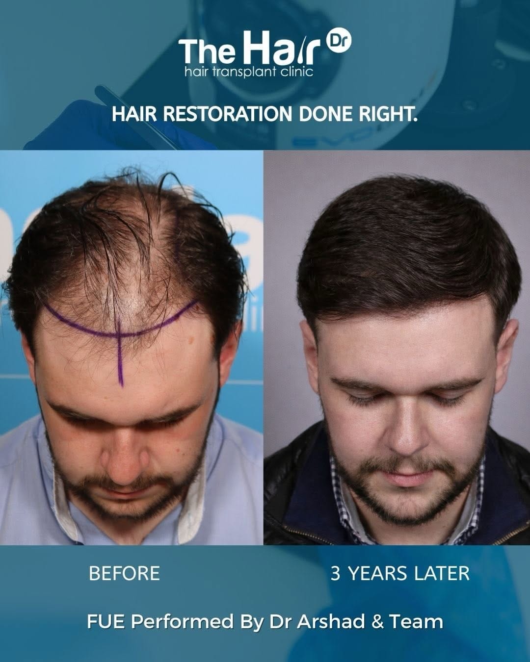Post 4 by The Hair Dr clinic on Instagram (carousel)