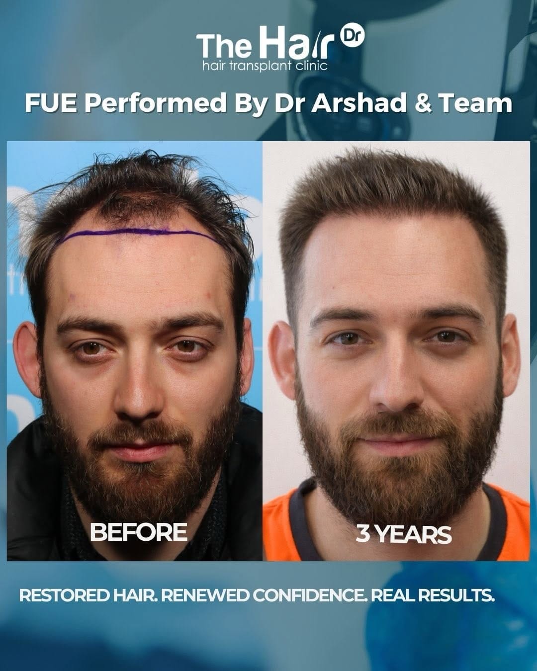 Post 5 by The Hair Dr clinic on Instagram (carousel)