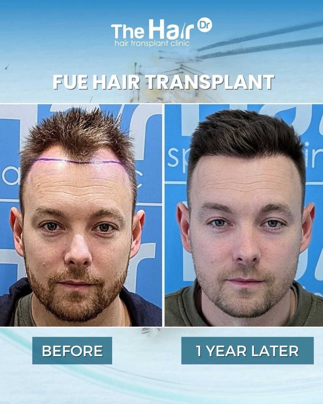 Post 3 by The Hair Dr clinic on Instagram (carousel)