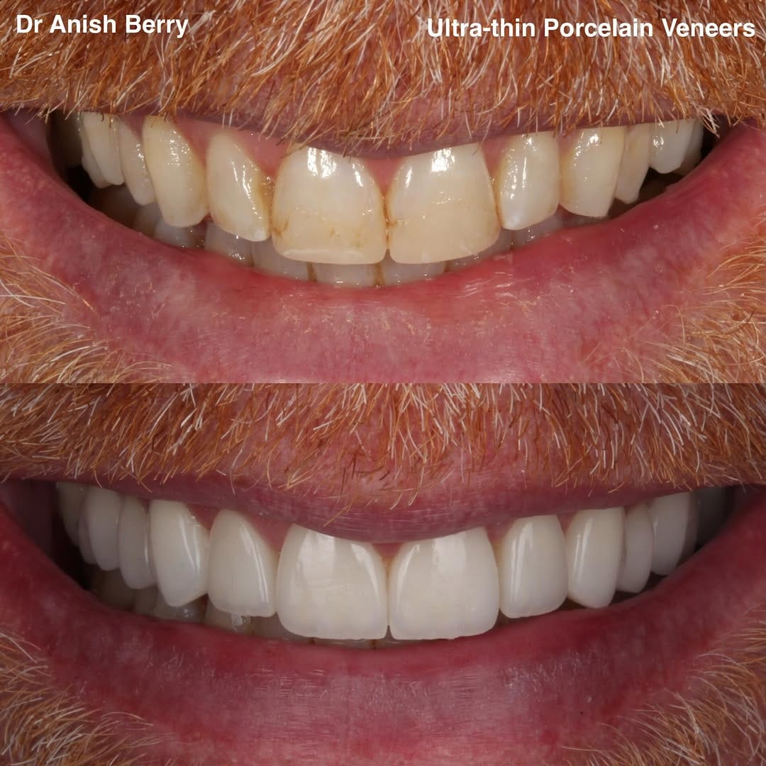 Post 2 by Anish Berry on Instagram (image)