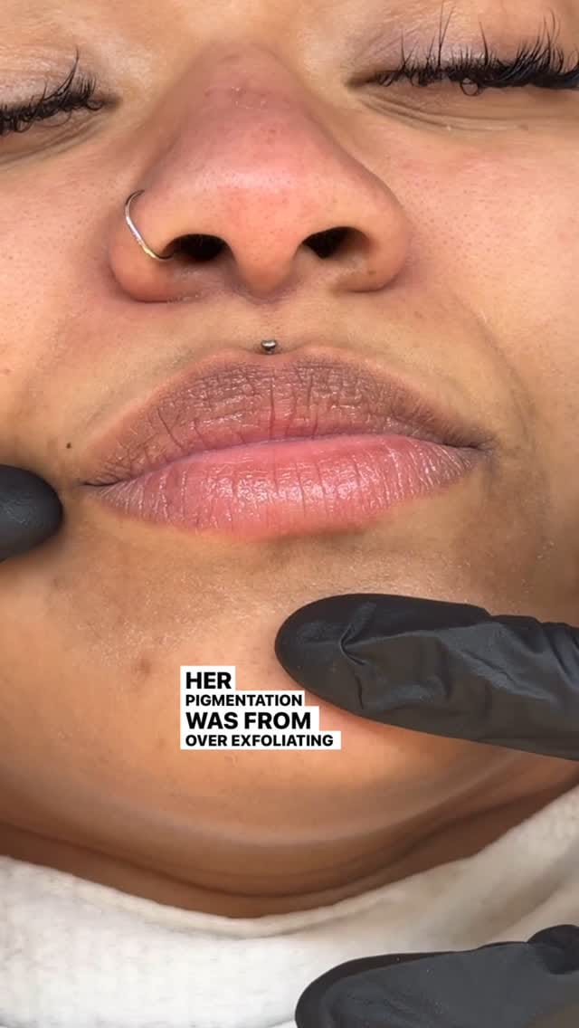 Post 1 by Facials | Skincare | Haircare on Instagram (video)