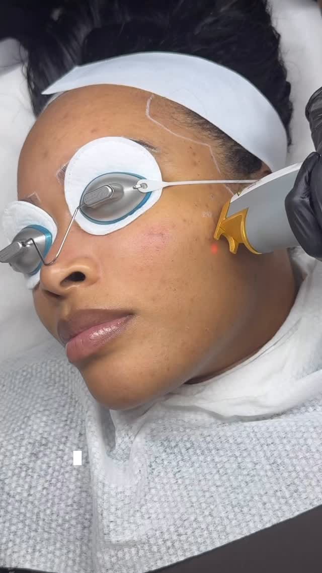 Post 4 by Facials | Skincare | Haircare on Instagram (video)