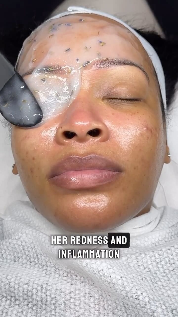 Post 6 by Facials | Skincare | Haircare on Instagram (video)