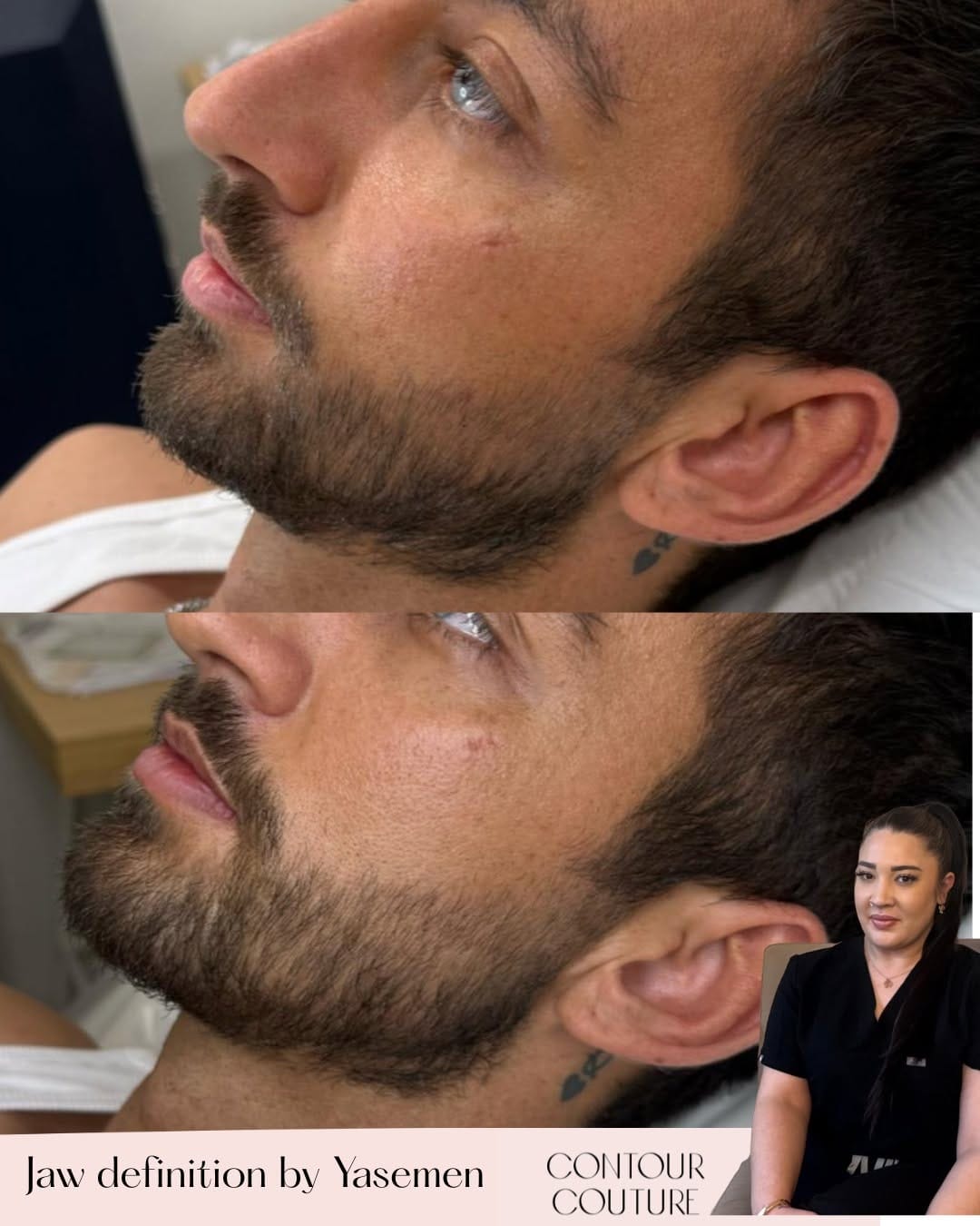 Post 6 by Contour Couture Aesthetic Clinics Swindon & Bristol on Instagram (image)