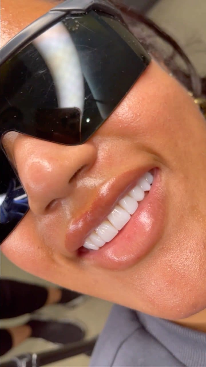 Post 4 by Royal Wharf Dental on Instagram (video)