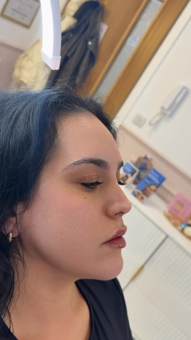 Post 8 by Nurse Prescriber Kat BSc INP | Medical Aesthetics London on Instagram (video)