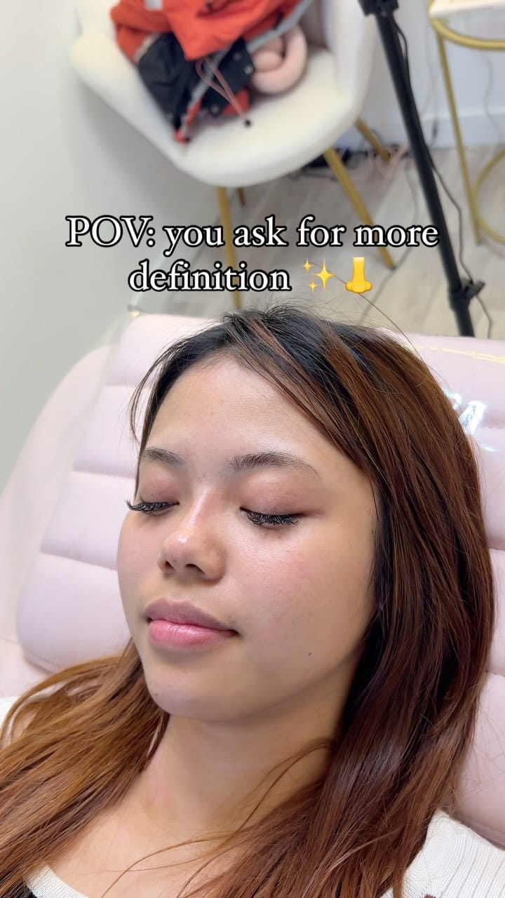 Post 9 by Nurse Prescriber Kat BSc INP | Medical Aesthetics London on Instagram (video)