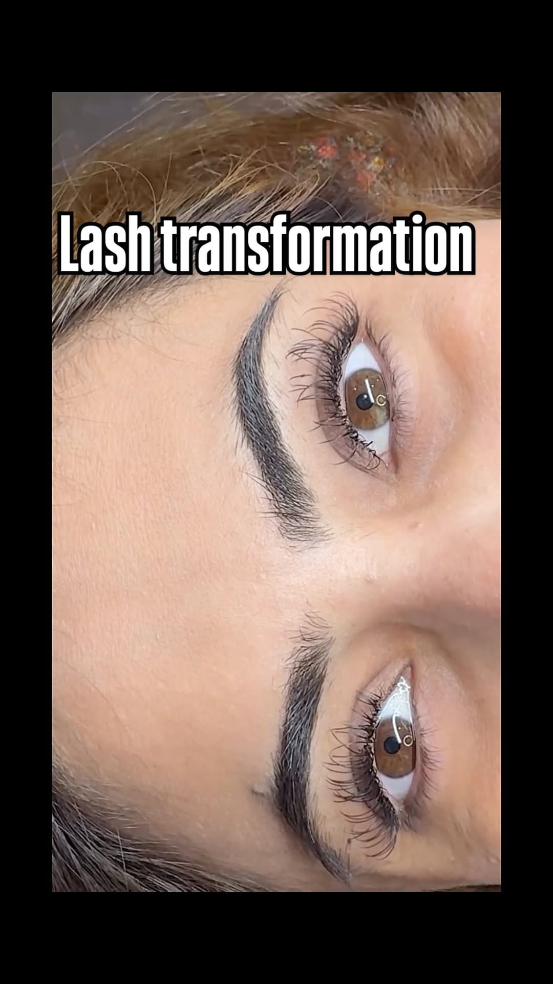 Post 6 by Aesthetic Clinic by Dr. Anna on Instagram (video)