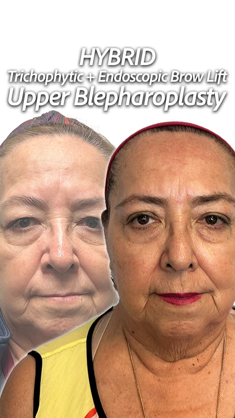 Post 7 by Giriraj K. Sharma, MD, FACS on Instagram (video)