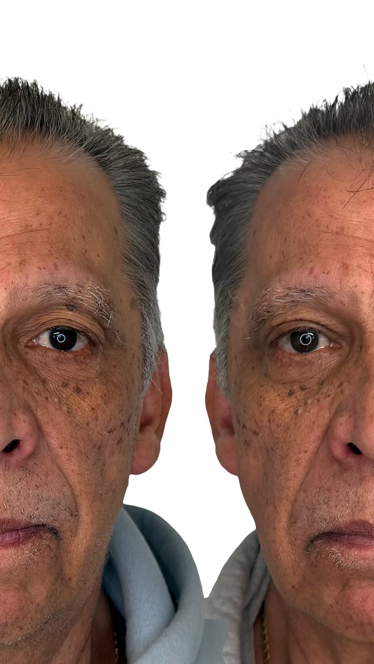 Post 3 by Giriraj K. Sharma, MD, FACS on Instagram (video)