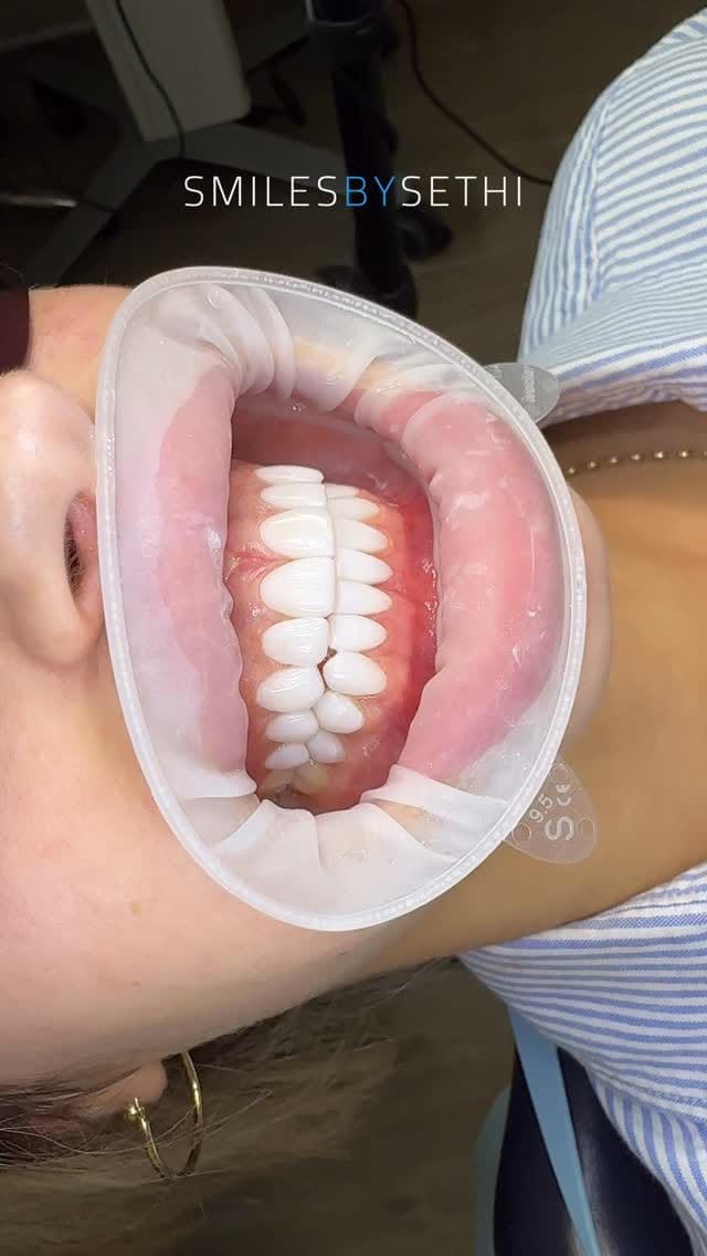 Post 1 by Dr Deepak Sethi on Instagram (video)