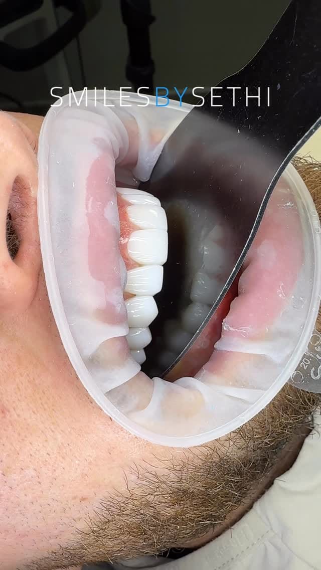 Post 4 by Dr Deepak Sethi on Instagram (video)