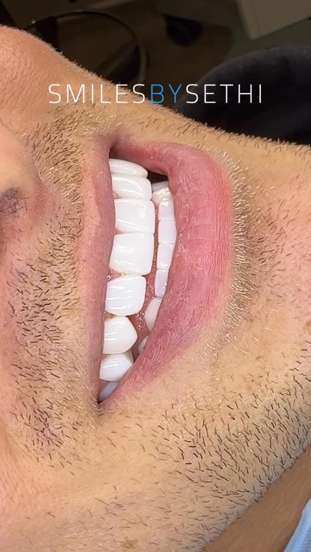 Post 6 by Dr Deepak Sethi on Instagram (video)