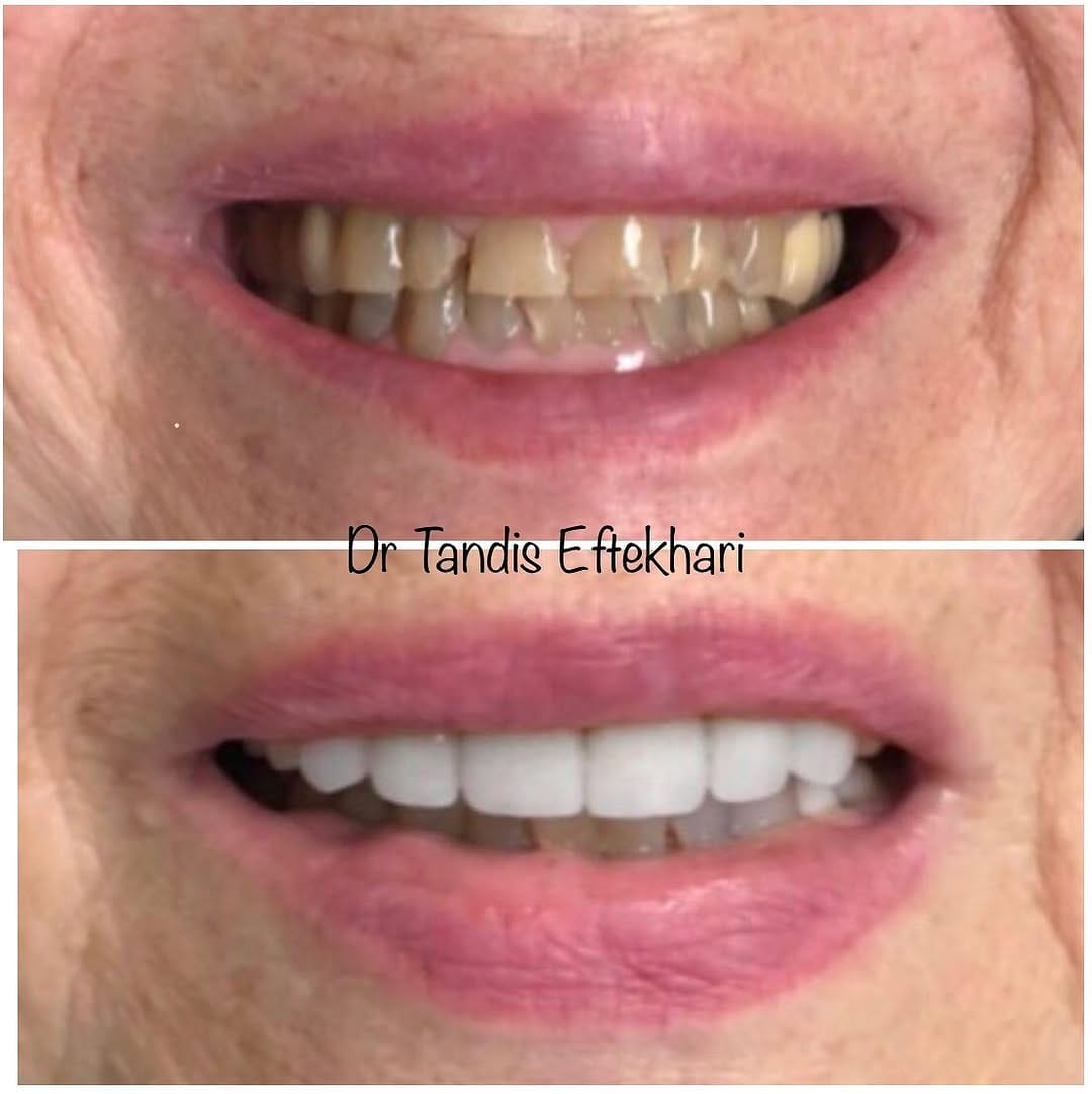 Post 10 by Dr. Tandis Eftekhari DMD on Instagram (image)