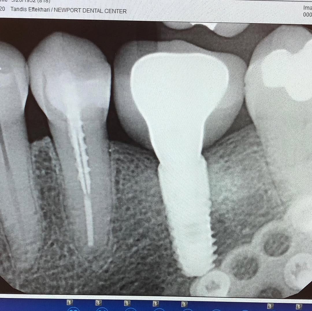 Post 4 by Dr. Tandis Eftekhari DMD on Instagram (image)