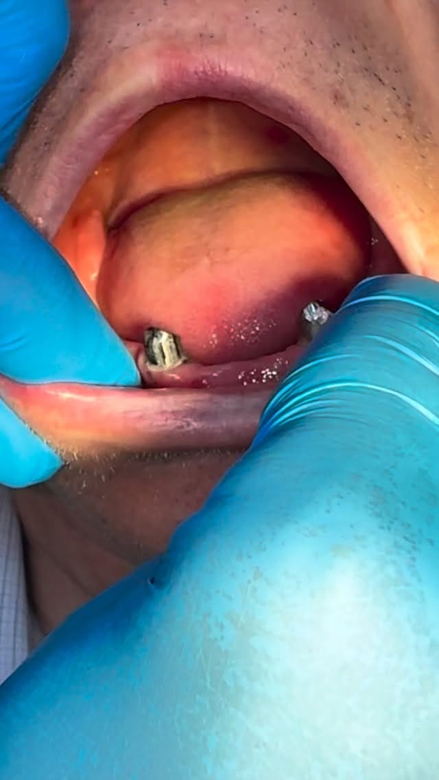 Post 1 by Ultradent dental clinic🦷 on Instagram (video)