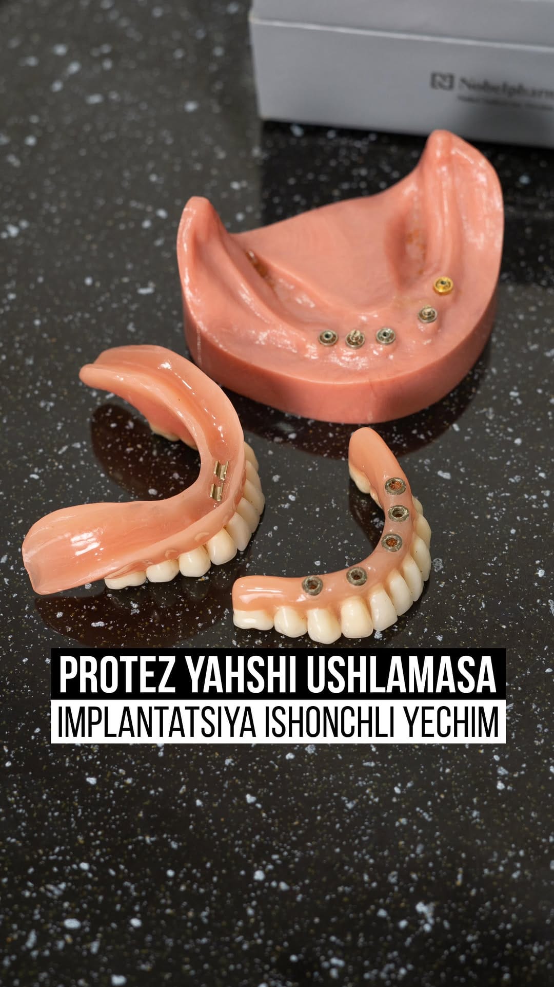 Post 6 by Ultradent dental clinic🦷 on Instagram (video)