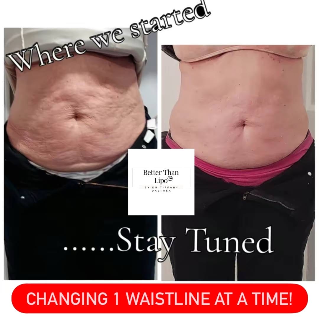 Post 7 by Tiffany Daltrea Body Skin Care on Instagram (image)
