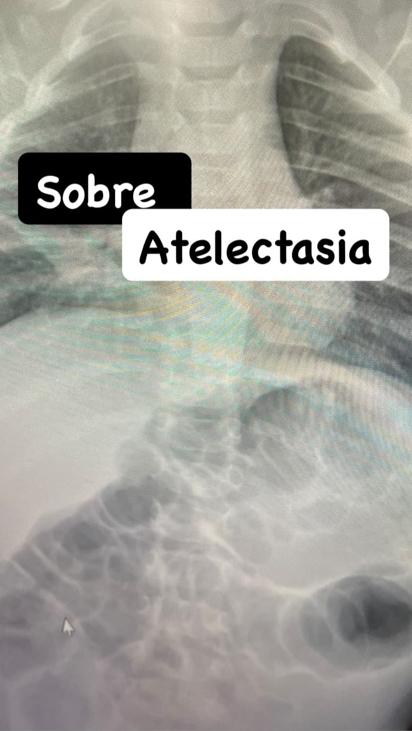 Post 5 by Felipe Rodriguez 🩺 Fisioterapeuta on Instagram (video)
