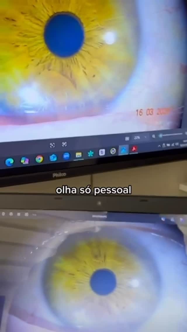 Post 8 by Instituto Brasileiro de Iridologia e Naturopatia on Instagram (video)