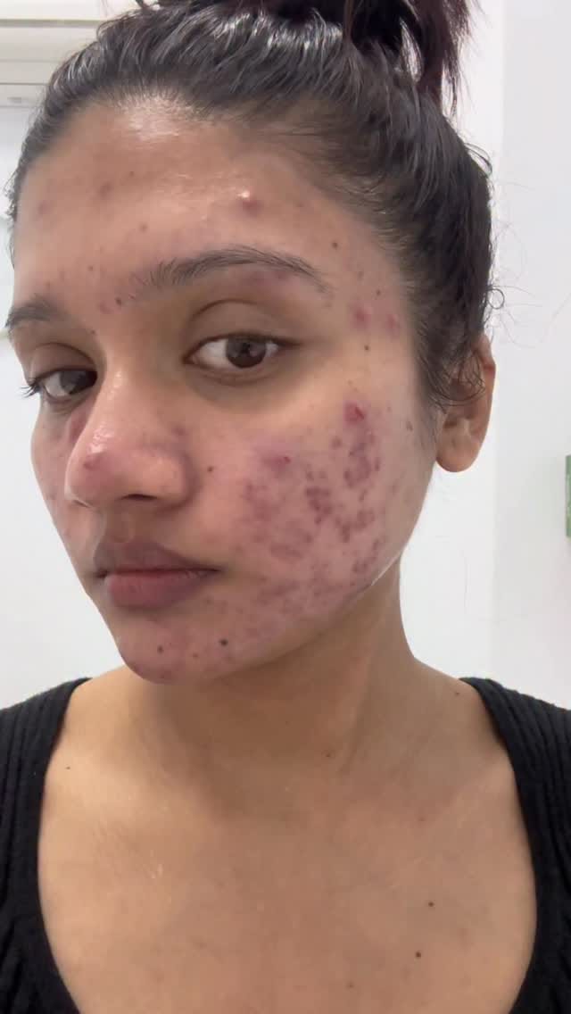 Post 2 by Mamata Thapa on Instagram (video)