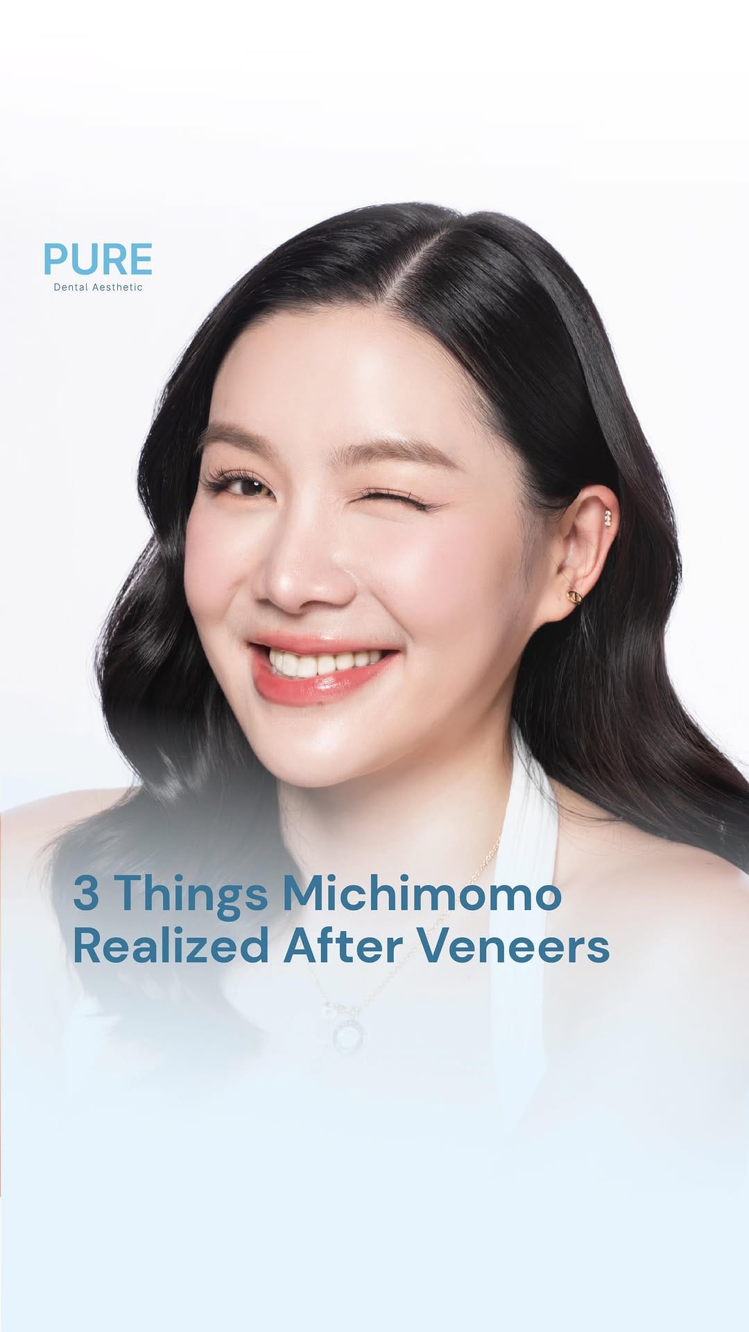 Post 5 by #1 Veneer Dental Clinic on Instagram (video)
