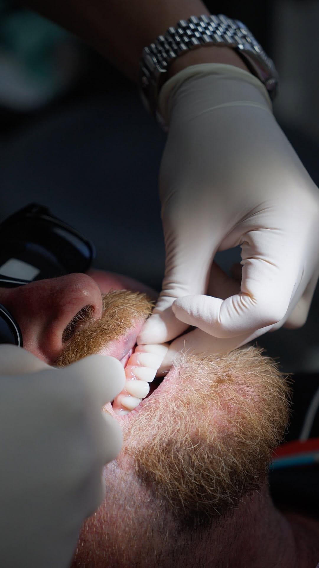Post 6 by Nova Dental Implant Centre 😁 on Instagram (video)