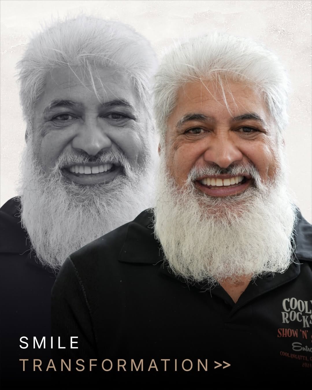 Post 4 by Nova Dental Implant Centre 😁 on Instagram (carousel)