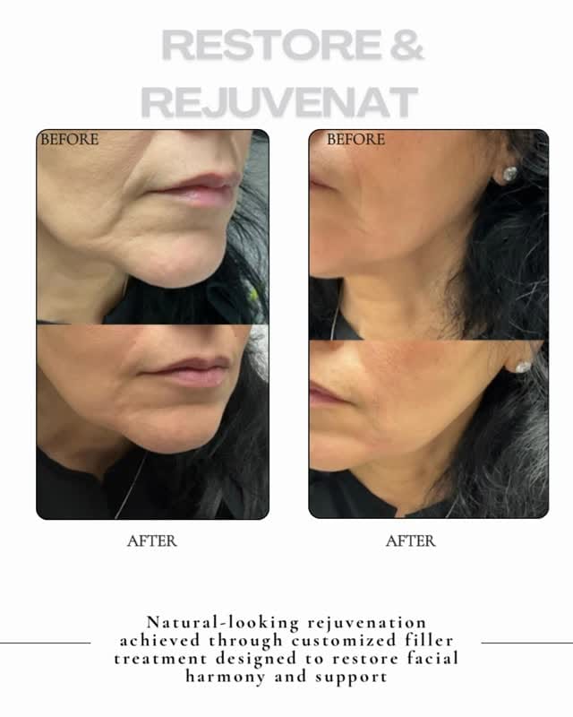 Post 3 by Angela Azar,MD,FAAD on Instagram (video)