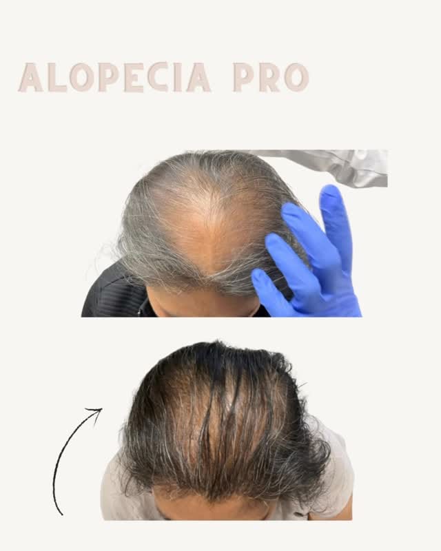 Post 6 by Angela Azar,MD,FAAD on Instagram (video)
