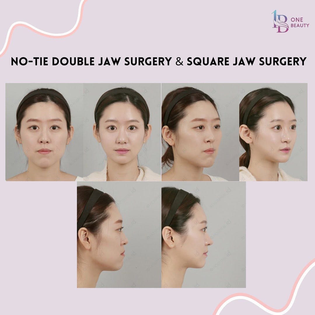 Post 4 by One Beauty Korea on Instagram (image)