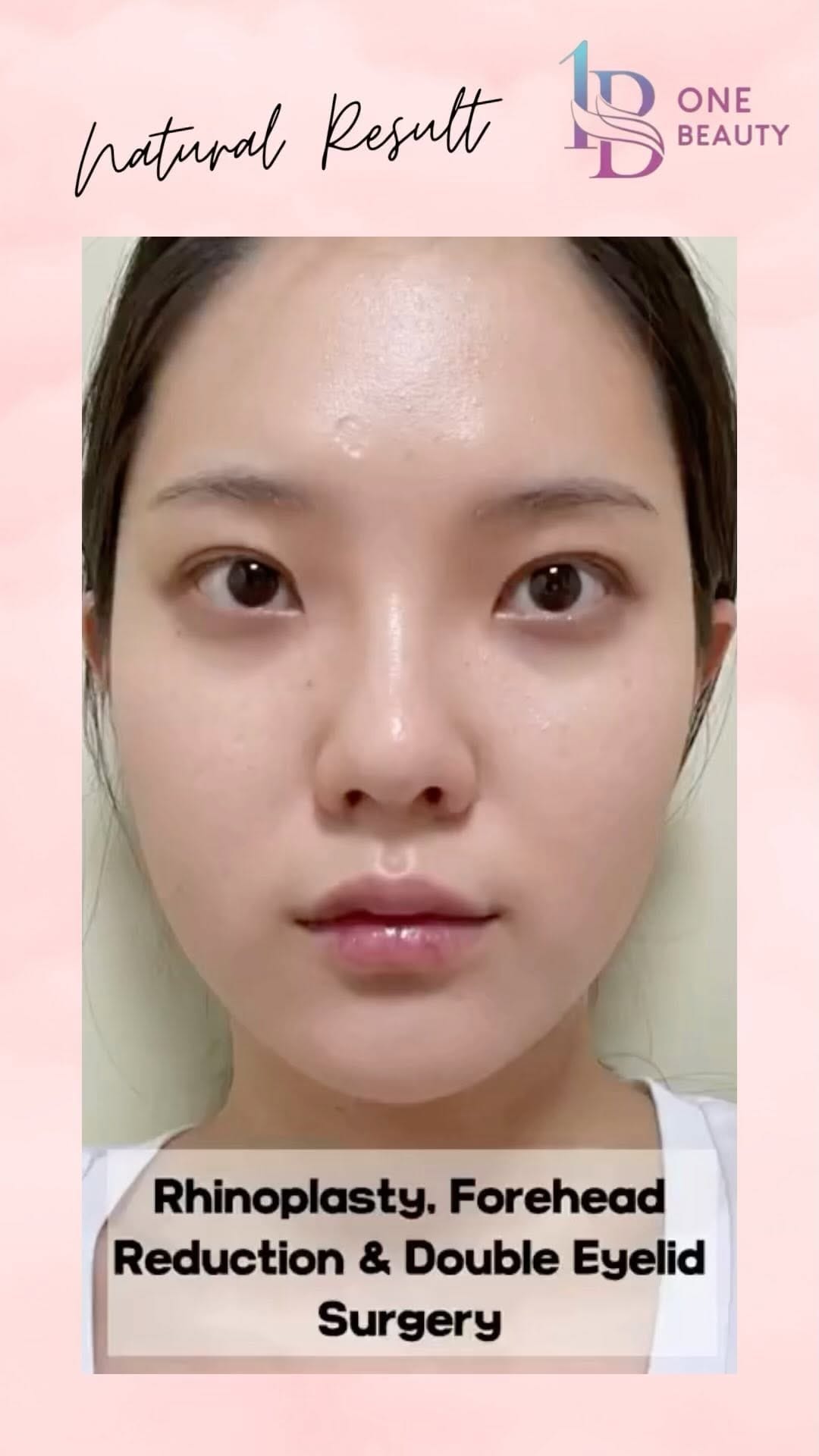 Post 3 by One Beauty Korea on Instagram (video)
